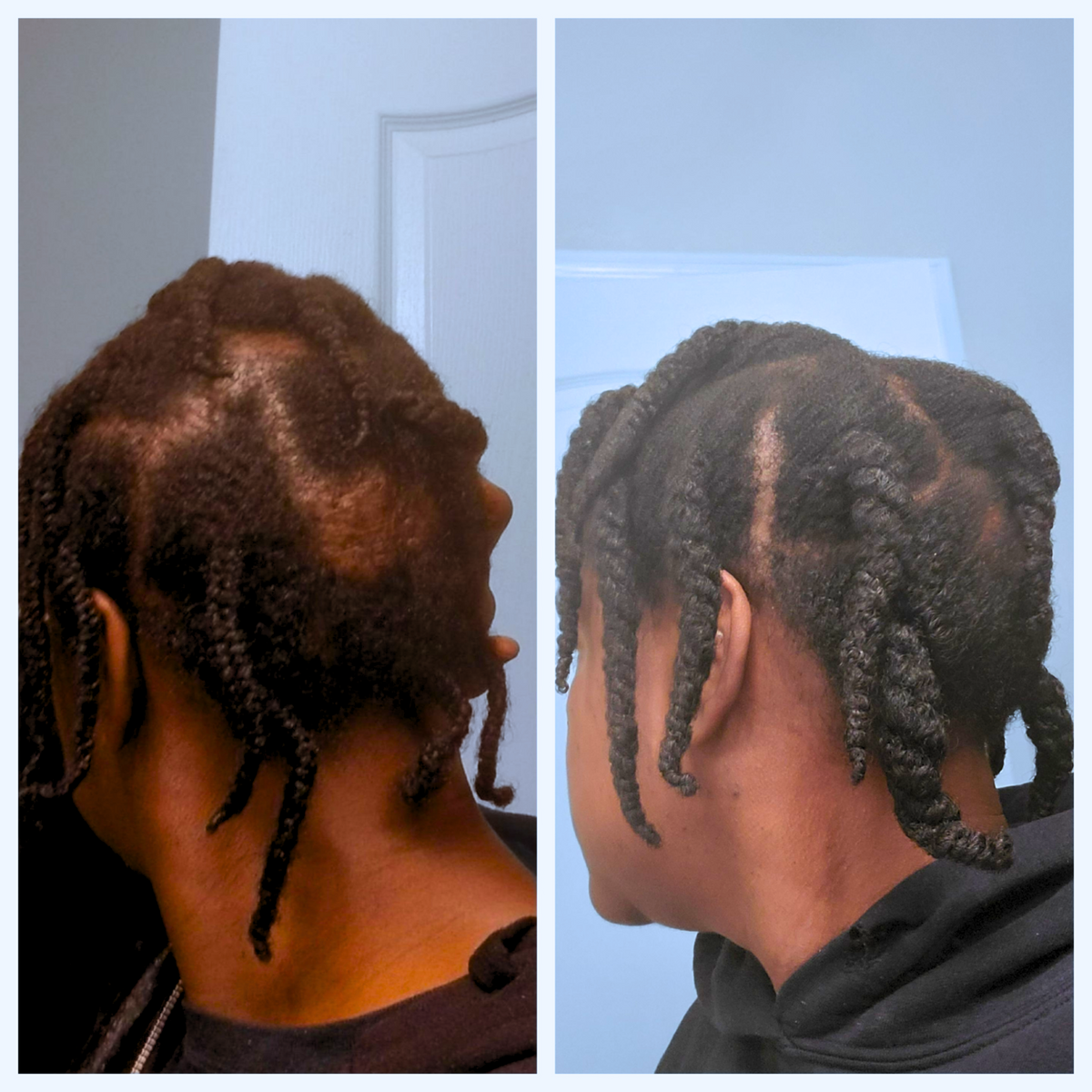 Glamour Growth Potion | Herbal Hair Oil