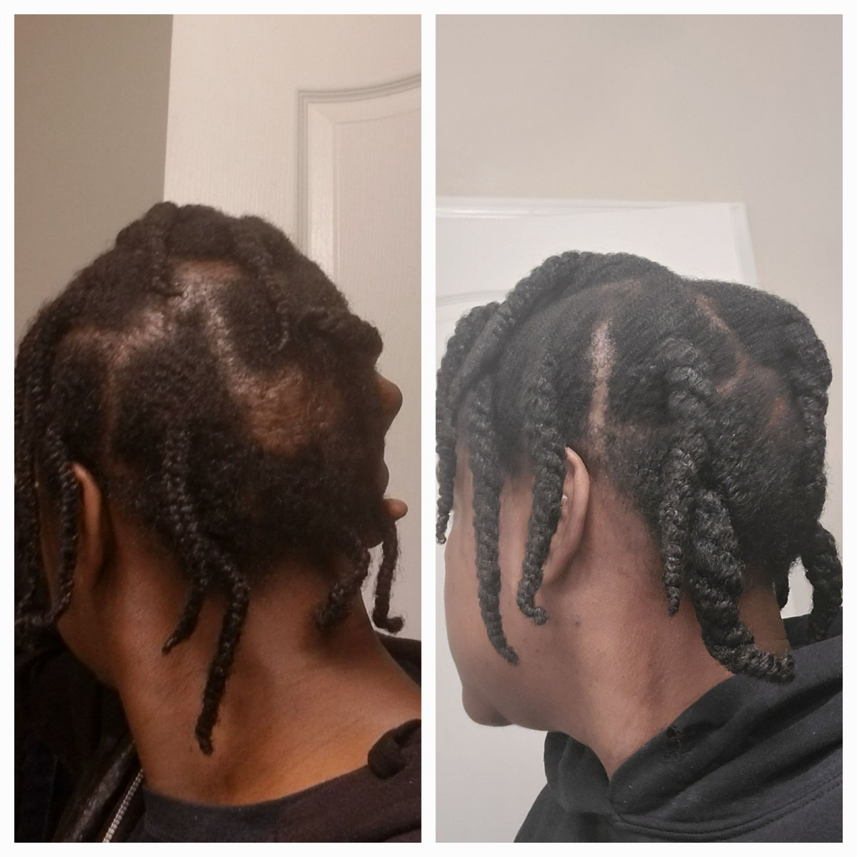 Revitalizing Hair Growth Oil